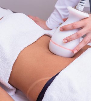 lipocavitation